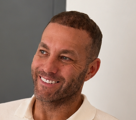 Hair transplant after photo showing Michael's natural hair restoration results