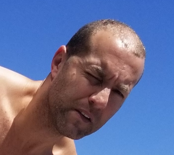Hair transplant before photo of Hairstoration founder Michael in Guadalajara